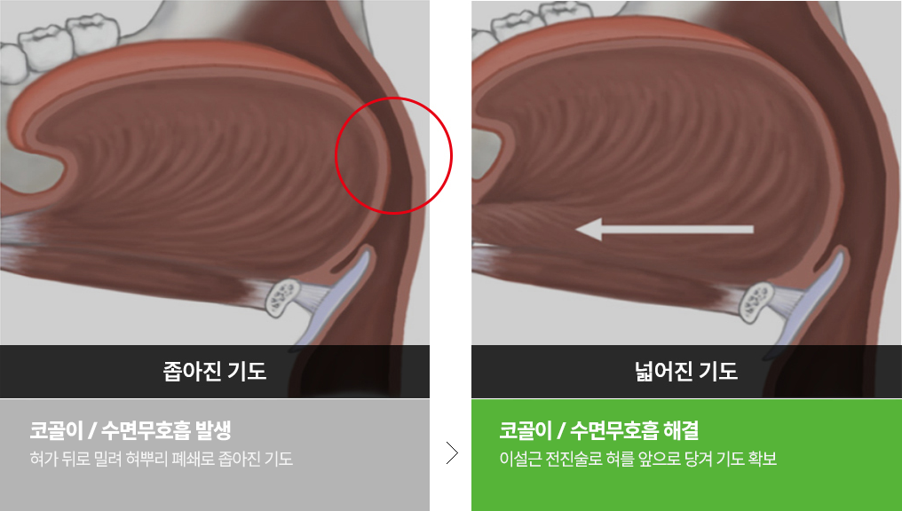 이미지명